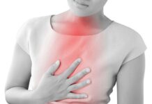 رفلاکس معده یا GERD چیست؟ 100580.jpeg alt_text