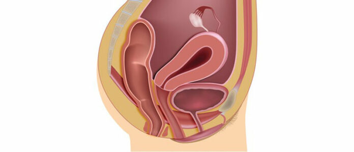 163830.jpeg title 163830.jpeg alt_text