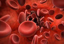 شایع ترین علل بروز کم خونی فقر آهن در خانمها 23066.jpeg alt_text