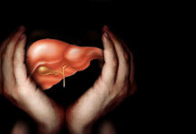 علل چربی کبد و درمان آن 232455.jpeg alt_text