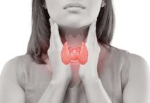 جراحی تیروئید و علل آن 237656.jpeg alt_text