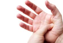 علل داغی کف دست 272845.jpeg alt_text