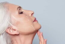 انواع لیفت با نخ 28435.jpeg alt_text