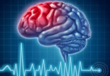 آیا سرطان مغز قابل درمان است؟ 333146.jpeg alt_text