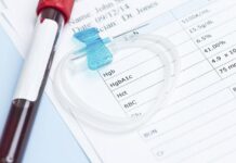 آزمایش هموگلوبین گلیکوزیله یا هموگلوبین A1C 422796.jpeg alt_text