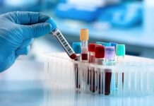 علت افزایش آنزیم های کبدی و عوارض آن 424631.jpeg alt_text