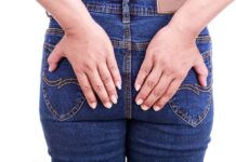 جوش روی باسن ، علل و روش های خلاصی آن 469815.jpeg alt_text