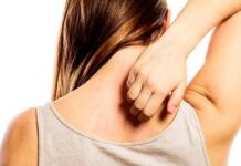 علت خارش و جوش شانه و کمر چیست؟ 493939.jpeg alt_text