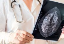 ماموگرافی چیست و چگونه انجام می شود؟ 560820.jpeg alt_text