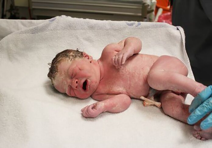 575890.jpeg alt_text