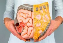 مهم ترین علل عدم تخلیه کامل مدفوع در بزرگسالان 603733.jpeg alt_text