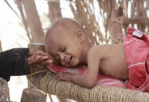 بیماری وبا در کودکان 606385.jpeg alt_text