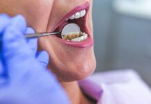 عوارض بی توجهی به عفونت دندان 689749.jpeg alt_text