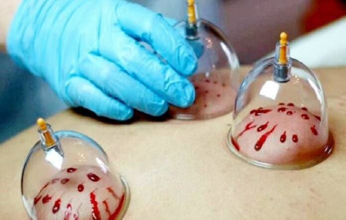 762140.jpeg alt_text