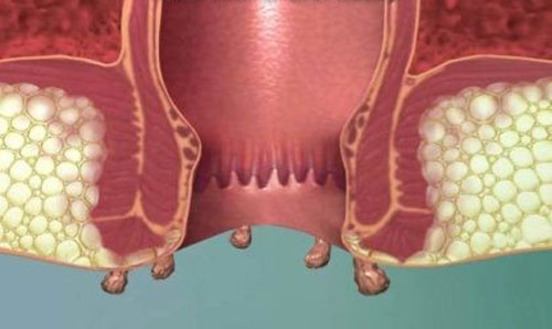 772061.jpeg alt_text