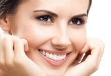 فرق بین کامپوزیت و لمینت دندان در چیست؟ 772807.jpeg alt_text