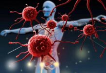 شایع ترین بیماریهای خودایمنی بدن بیماریهای خودایمنی بدن