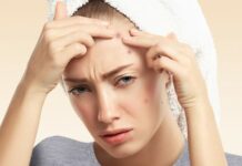 آکنه کیستیک و درمان آن علت بروز آکنه کیستیک