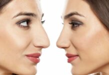 بهترین جراح بینی در تهران بهترین جراح بینی در تهران