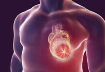 دلایل ایست قلبی دلایل ایست قلبی