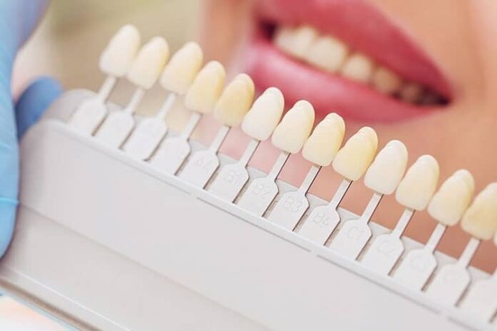 عوارض زیبایی دندان