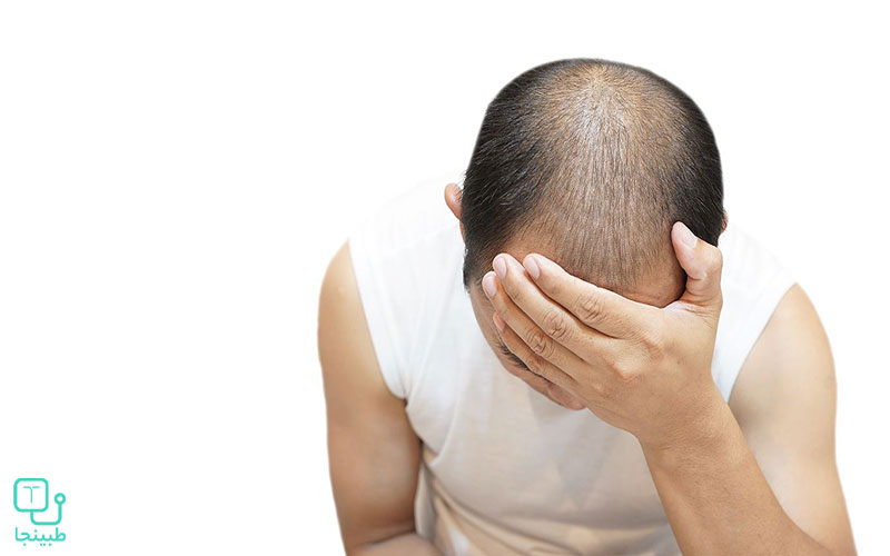 ریزش مو در اثر خودارضایی